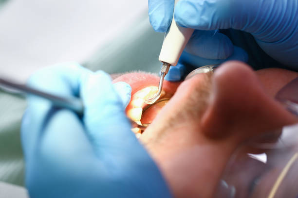 Best Pediatric Emergency Dentist in Maquoketa, IA