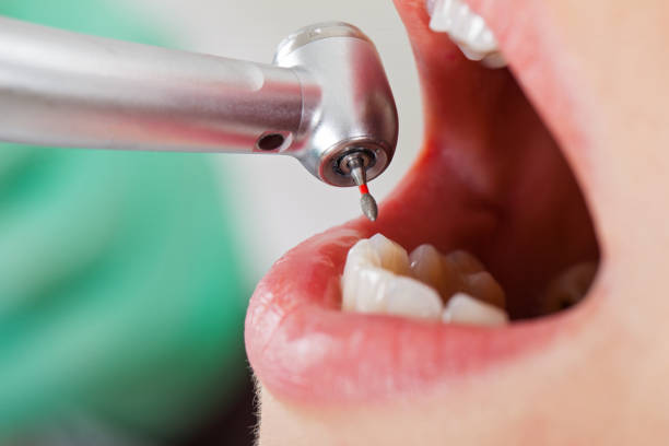 Best Emergency Gum Treatment in Maquoketa, IA